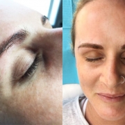 cosmetic tattoo eyebrow reshape